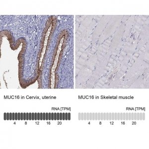 Anti-MUC16 