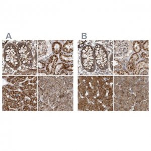 Anti-MUT antibody produced in rabbit 