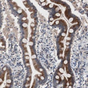 Anti-MUTYH antibody produced in rabbit 