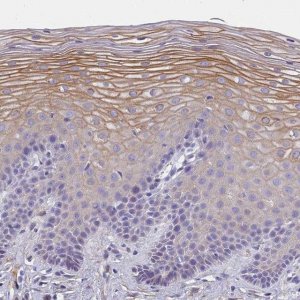 Anti-MVB12A antibody produced in rabbit 