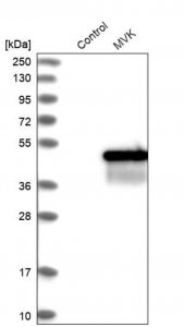 Anti-MVK antibody produced in rabbit HPA016961-100UL