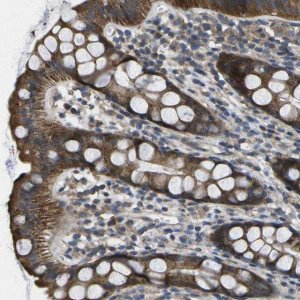 Anti-MVK antibody produced in rabbit HPA016961-100UL