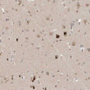 Anti-MXI1 antibody produced in rabbit 