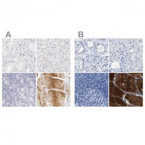Anti-MYBPC1 antibody produced in rabbit 