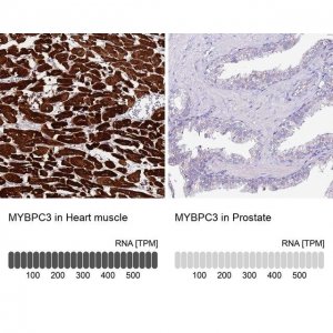 Anti-MYBPC3 antibody produced in rabbit 