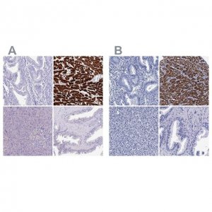 Anti-MYBPC3 antibody produced in rabbit 