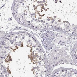 Anti-MYCBPAP antibody produced in rabbit 
