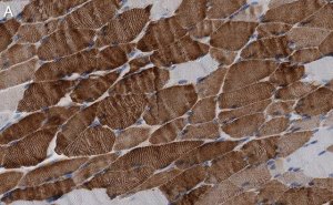 Anti-MYH1 Antibody, clone 1E15 , ZooMAb Rabbit Monoclonal 