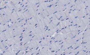 Anti-MYH1 Antibody, clone 1E15 , ZooMAb Rabbit Monoclonal 