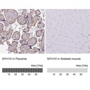 Anti-MYH10 antibody produced in rabbit 