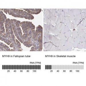 Anti-MYH9 HPA064783-100UL