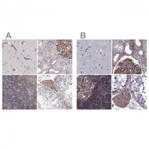 Anti-MYH9 HPA064783-100UL