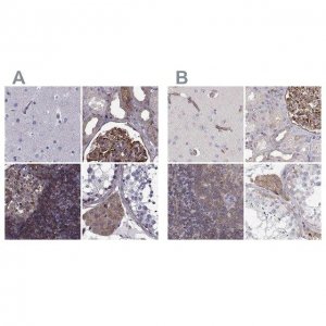 Anti-MYH9 antibody produced in rabbit 