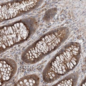 Anti-MYL5 antibody produced in rabbit HPA037381-100UL