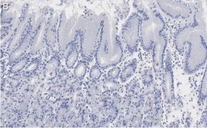 Anti-MYO1C Antibody, clone 4B19, ZooMAb Rabbit Monoclonal 