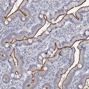 Anti-MYO7B antibody produced in rabbit 