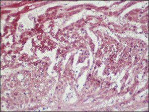 Anti-Myocardin antibody produced in rabbit SAB4200539-200UL