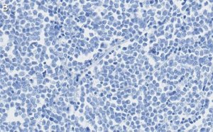 Anti-MyoD Antibody, clone 1F22 ZooMAb Rabbit Monoclonal 