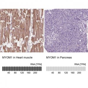 Anti-MYOM1 antibody produced in rabbit 