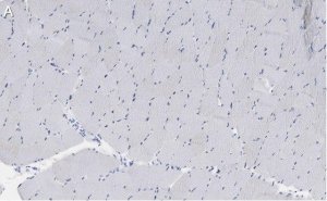 Anti-Myosin Heavy Chain 7 Antibody, clone 1B19, ZooMAb Rabbit Monoclonal 