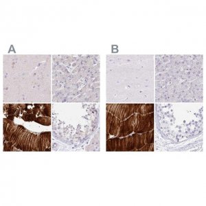 Anti-MYOZ1 antibody produced in rabbit 