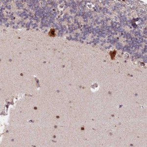 Anti-N4BP2L1 antibody produced in rabbit 