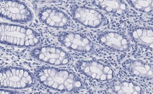Anti-Na+-K+ ATPase 1 Antibody, clone 1E13 ZooMAb Rabbit Monoclonal 