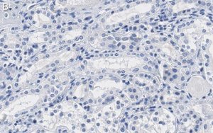 Anti-Na+/K+ ATPase -1 Antibody, clone C464.6 ZooMAb Mouse Monoclonal 