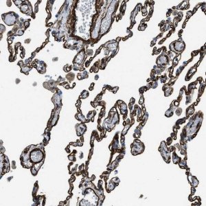 Anti-NAB1 antibody produced in rabbit 