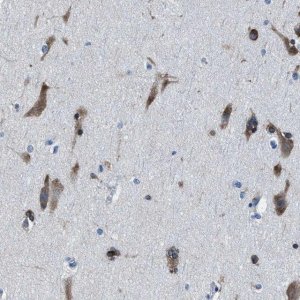 Anti-NACAD antibody produced in rabbit 