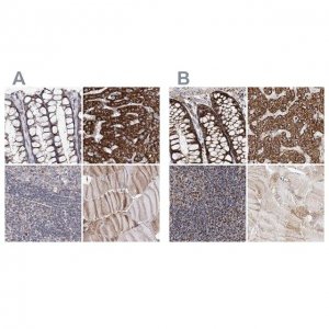 Anti-NADK2 antibody produced in rabbit 