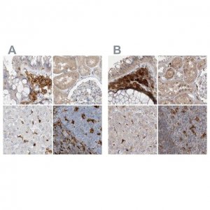 Anti-NAGK antibody produced in rabbit 