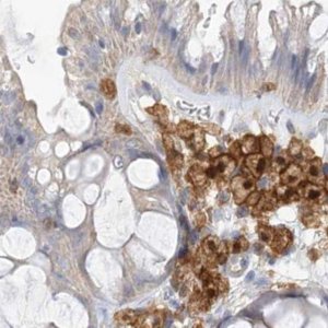 Anti-NAGK antibody produced in rabbit 