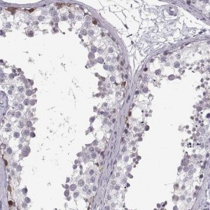 Anti-NANOS3 antibody produced in rabbit 