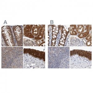 Anti-NAPRT antibody produced in rabbit 