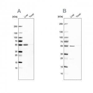 Anti-NAPRT antibody produced in rabbit 