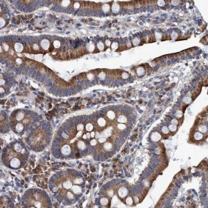 Anti-NAT16 antibody produced in rabbit 