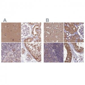 Anti-NAXE antibody produced in rabbit 
