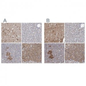 Anti-NBEA antibody produced in rabbit 