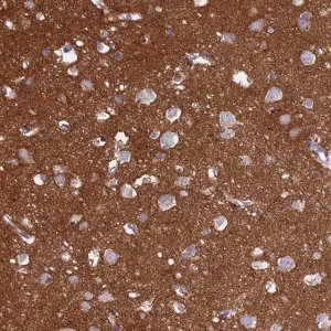 Anti-NCAM1 antibody produced in rabbit HPA039835-100UL