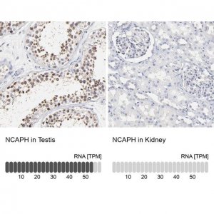 Anti-NCAPH antibody produced in rabbit 