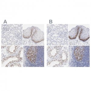Anti-NCAPH antibody produced in rabbit 