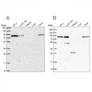 Anti-NCBP1 antibody produced in rabbit HPA049031-100UL