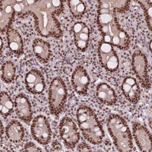 Anti-NCBP1 antibody produced in rabbit HPA049031-100UL
