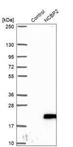 Anti-NCBP2 antibody produced in rabbit HPA044850-100UL