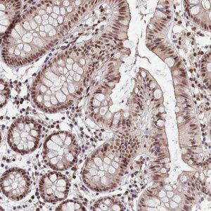 Anti-NCBP2 antibody produced in rabbit HPA044850-100UL