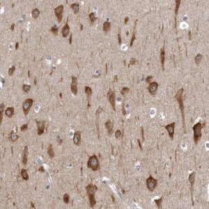 Anti-NCEH1 antibody produced in rabbit 