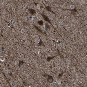 Anti-NCKAP1 antibody produced in rabbit 