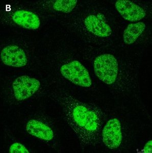 Anti-NCOA1 Antibody, clone 5B9, ZooMAb Rabbit Monoclonal 