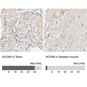 Anti-NCOA6 antibody produced in rabbit 
